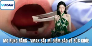 mơ rụng răng